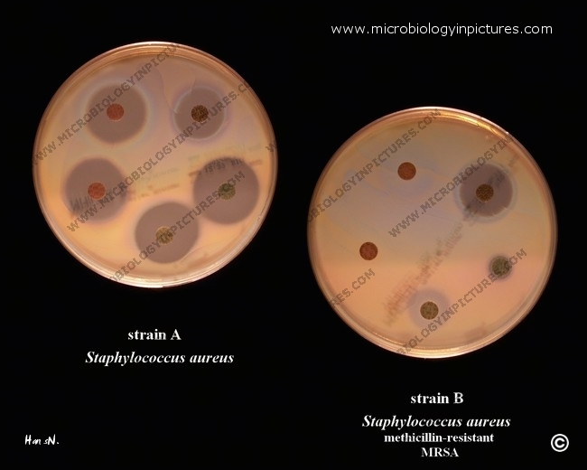 antibiotic-susceptibility-test-staphylococcus-aureus-and-mrsa